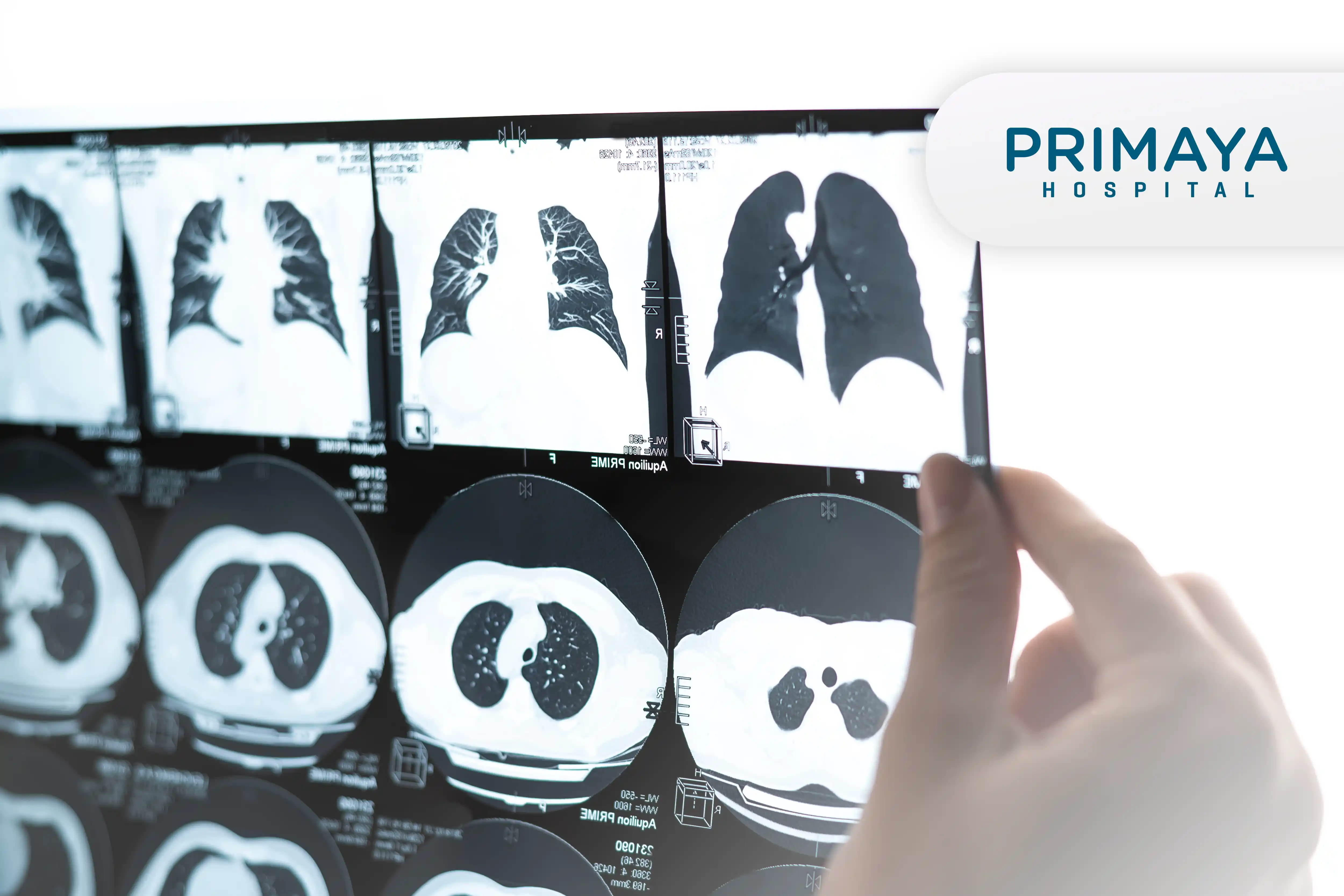 https://api.oneonco.co.id/storage/photo/product/CT Scan Thorax Lung - primaya_1741941101.webp